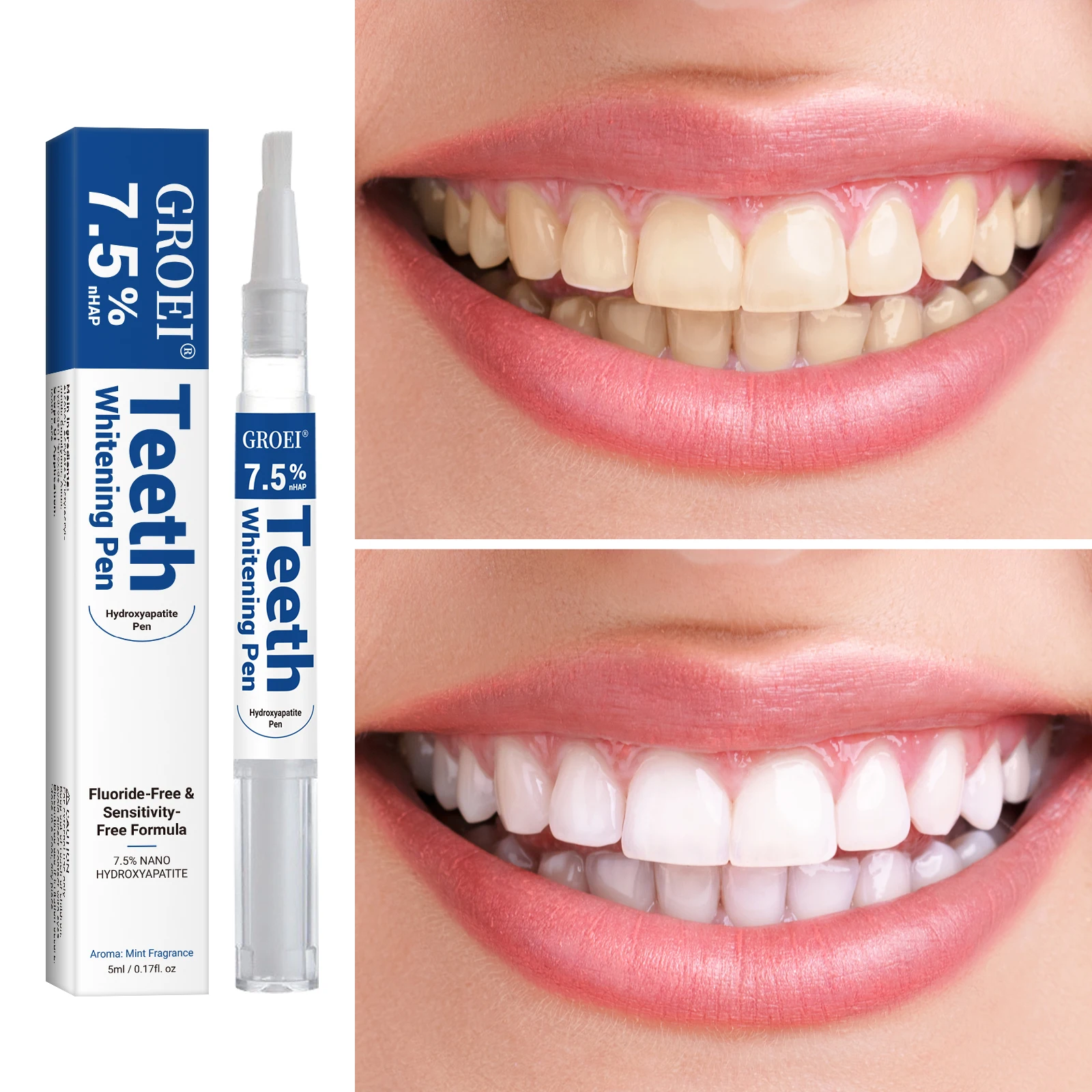 Hydroxyapatite Tooth Whitening - مراجعة Teeth Whitening From Home وسعره