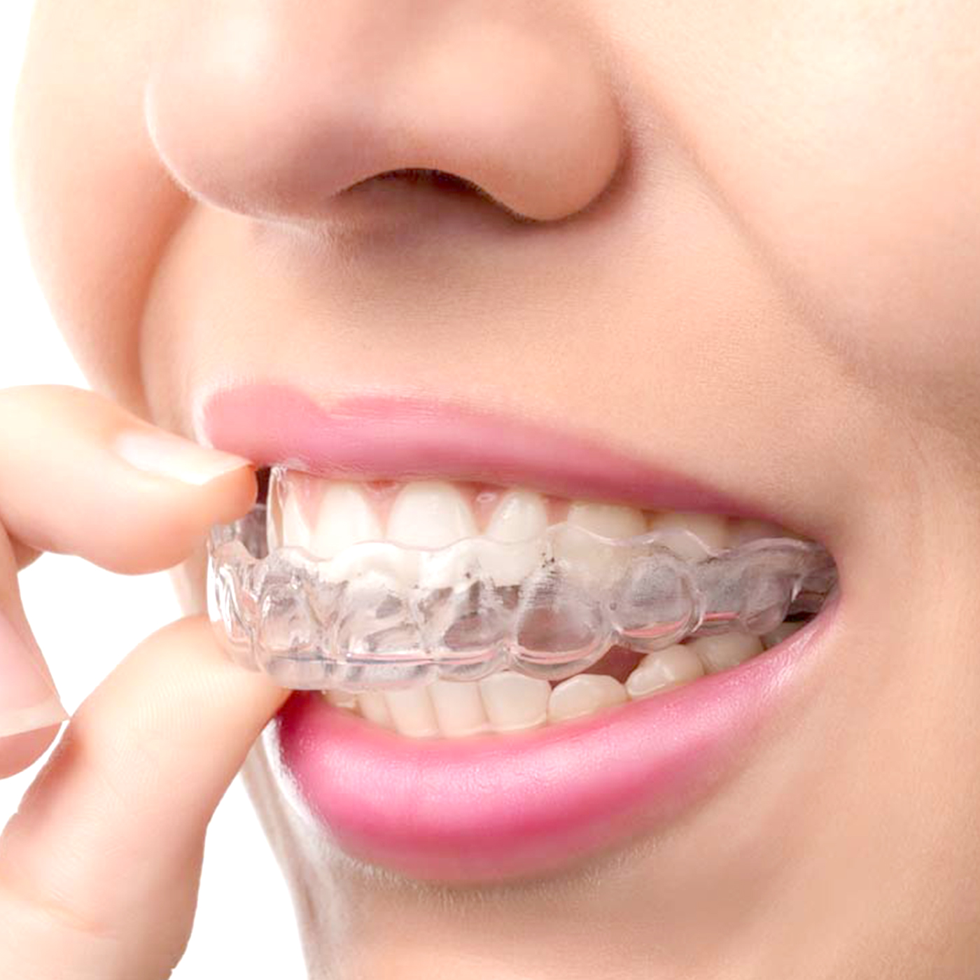 1Pc/2Pcs Transparent Teeth Tra - مراجعة Teeth Whitening With Trays وسعره