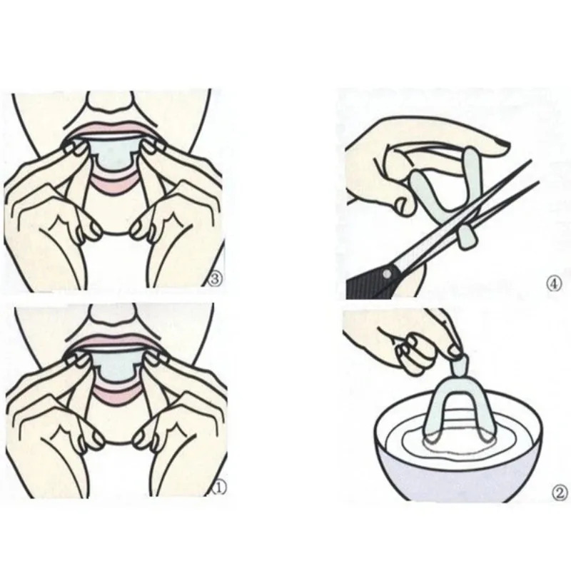 1/3/6pairs Silicone Mouth Guar - مراجعة Teeth Whitening With Trays وسعره