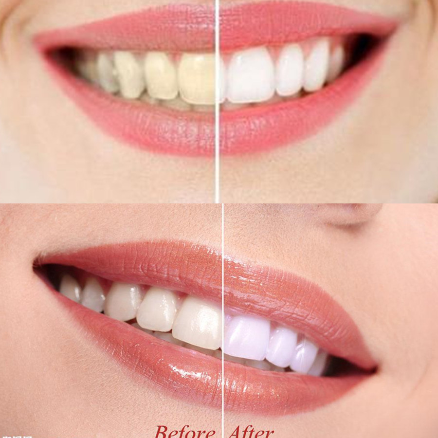 Bamboo Charcoal Teeth Tooth De - مراجعة Teeth Whitening From Home وسعره