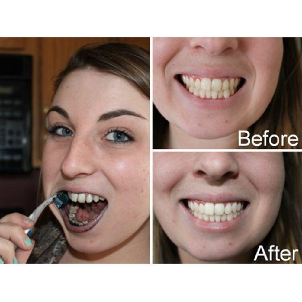 Bamboo Charcoal Teeth Tooth De - مراجعة Teeth Whitening From Home وسعره