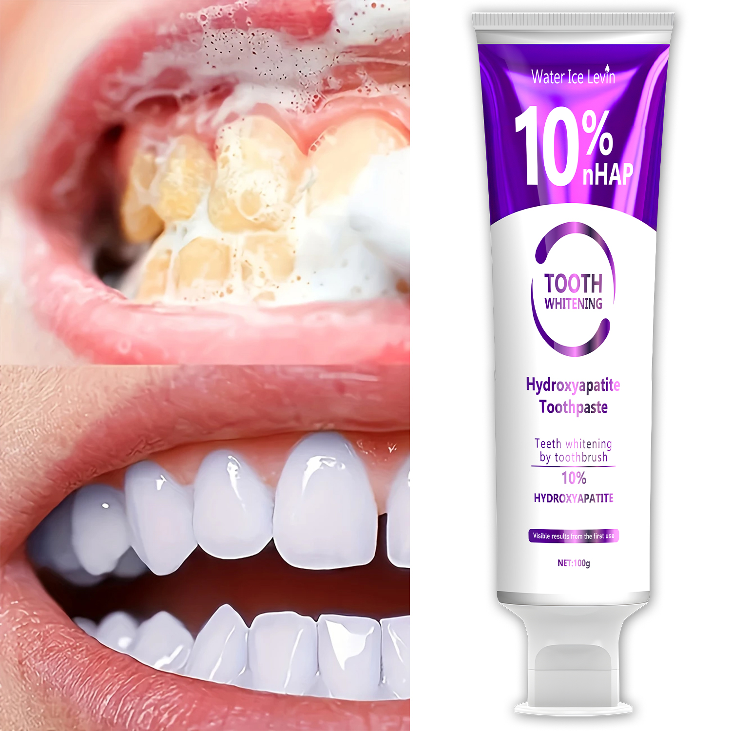 10% Nanoh Hydrogen Oxide Tooth - مراجعة Hydroxyapatite Toothpaste وسعره