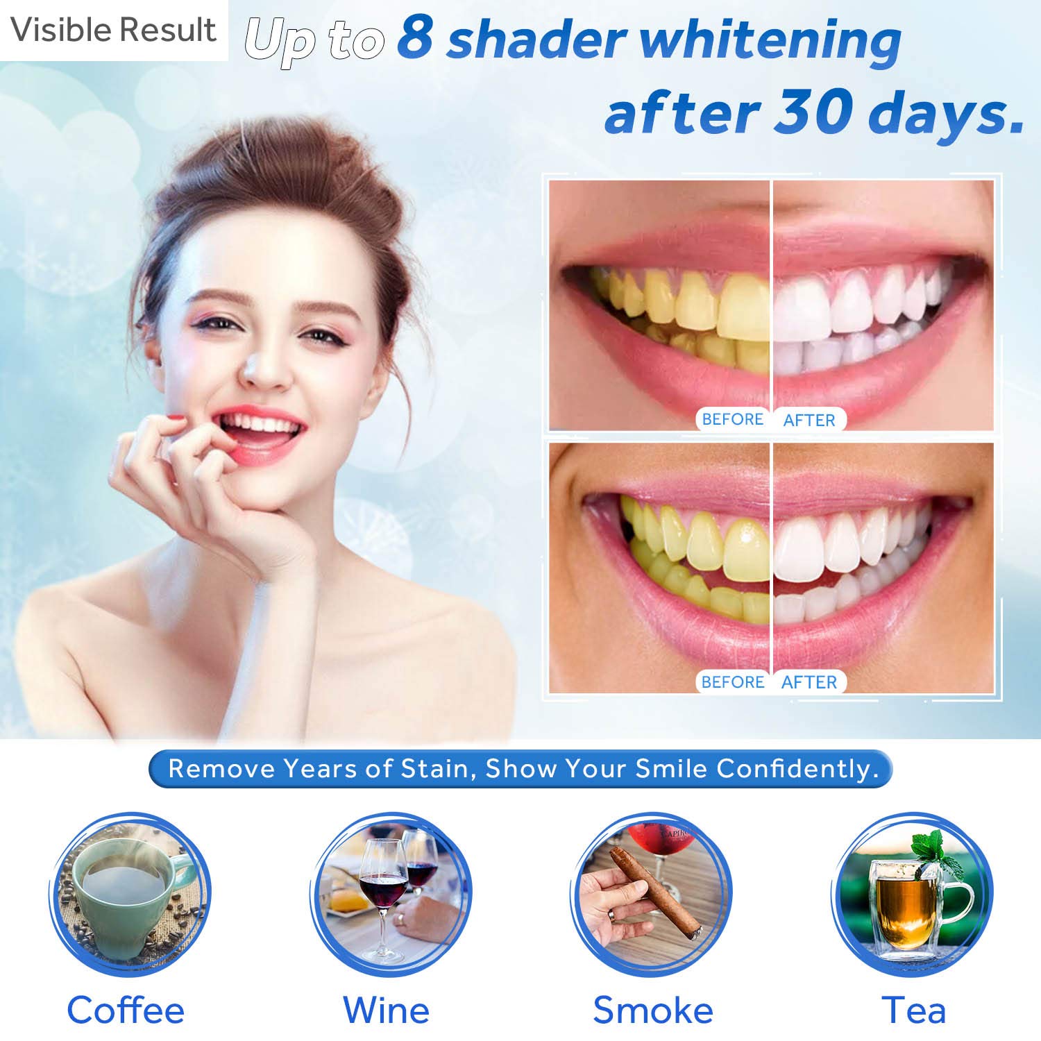 Teeth Whitening Gel Refill Syr - مراجعة Teeth Whitening With Trays وسعره