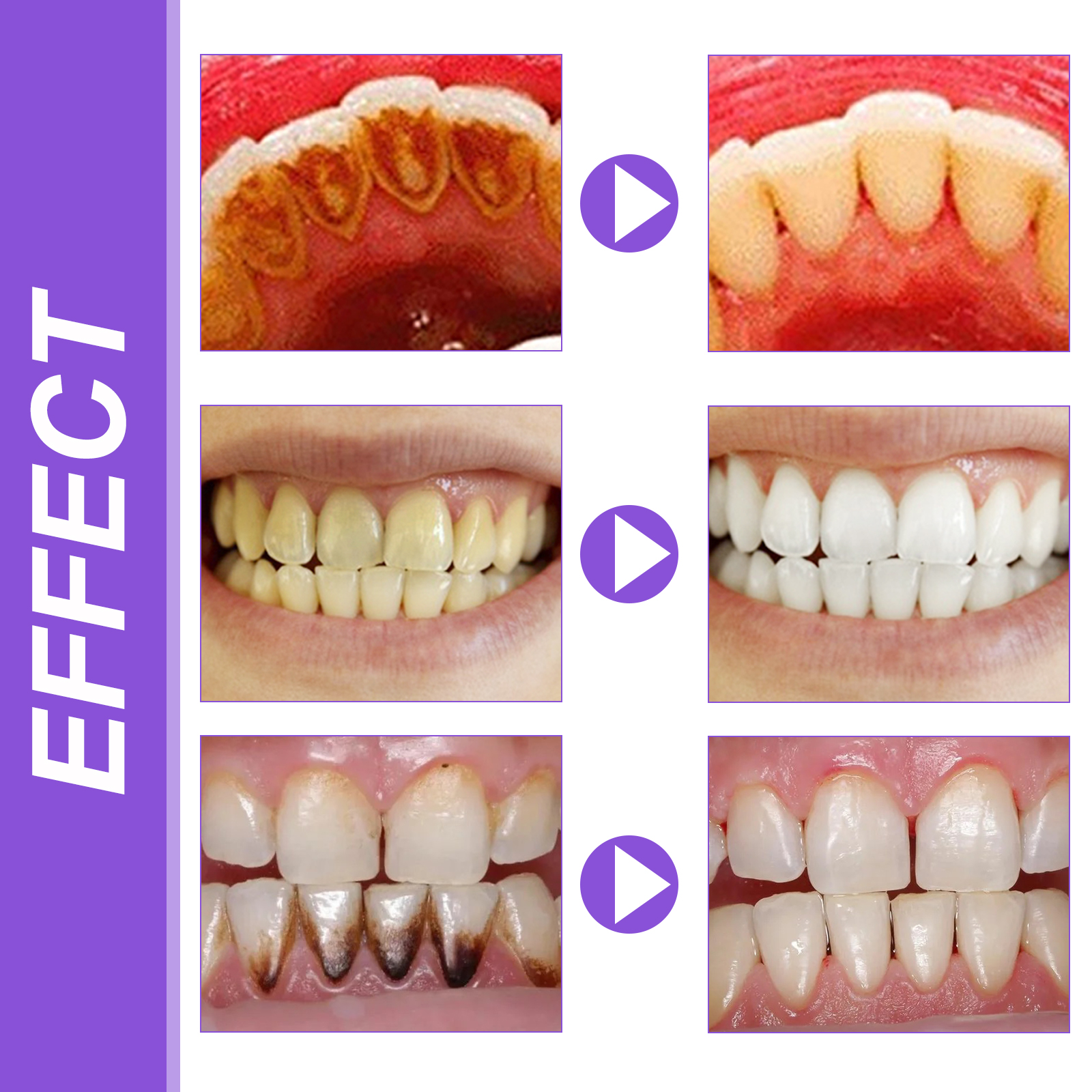 EELHOE Smiles Bright White Ref - مراجعة Hydroxyapatite Toothpaste وسعره