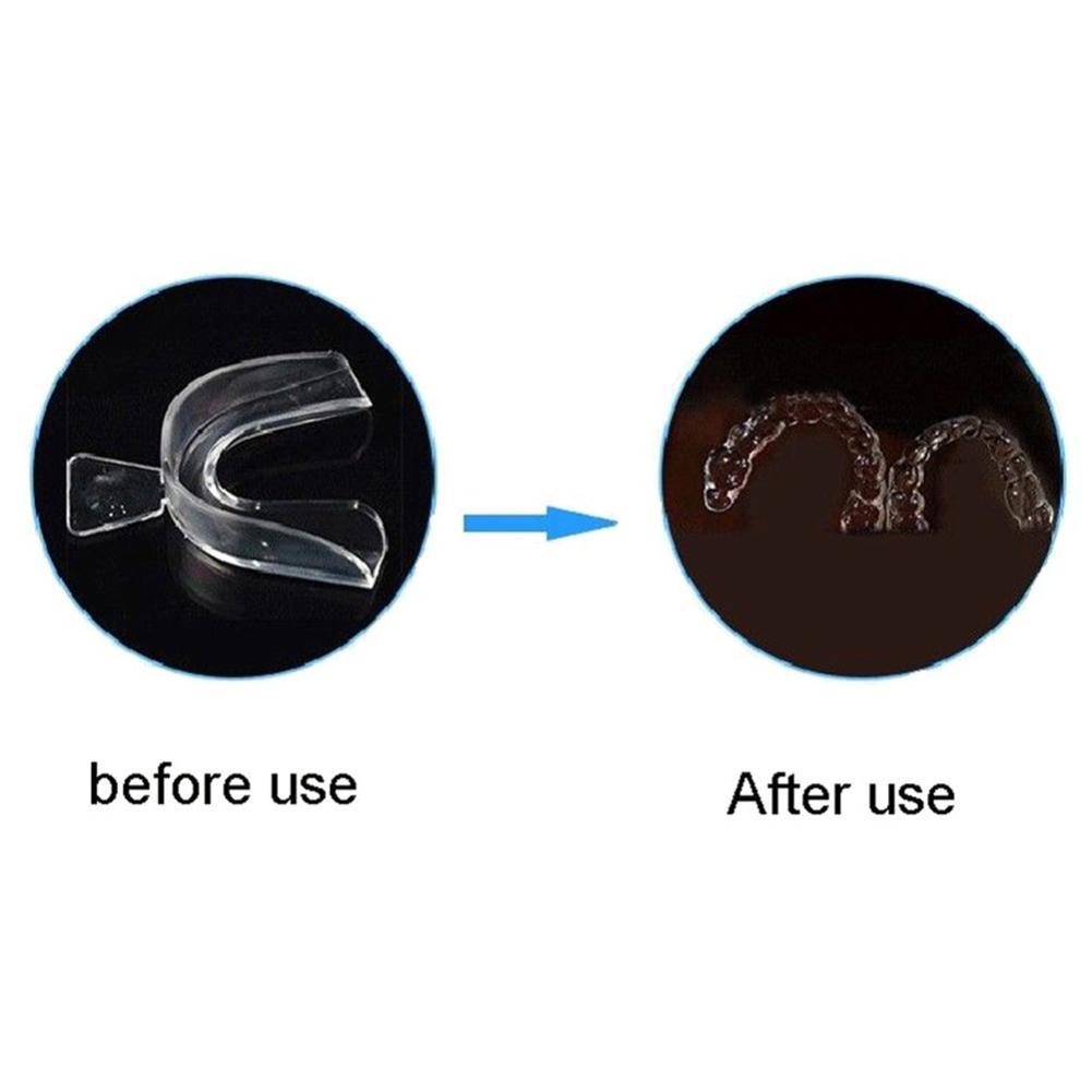 Silicone Mouth Guard Orthodont - مراجعة Teeth Whitening With Trays وسعره